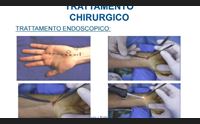 patologie della mano trattamenti mininvasivi e riabilitazione