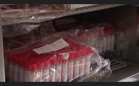 sassari allo zooprofilattico da aprile processati oltre 14mila tamponi
