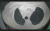 radiologi gli occhi della pandemia attiviamo la radiografia a domicilio