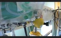 covid pregliasco il virus circola ancora da non sottovalutare