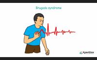 oliena il cardiologo brugada prevenzione contro la morte improvvisa