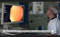 cancro del colon retto importante aderire alle campagne di prevenzione