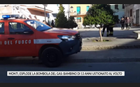 monti esplode la bombola del gas bambino di 13 anni ustionato al volto
