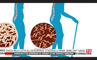 svolta nella lotta all osteoporosi a iglesias la prima bone unit sarda