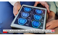 alzheimer in sardegna 15mila casi la sfida tra prevenzione e nuove cure
